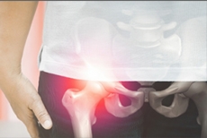 Can Patients With Hip Retroversion Still Have Good Long-Term Outcomes After Hip Arthroscop...