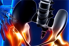 Do the Results of Hip Arthroscopy Last? Five-Year Outcomes in Basketball Players