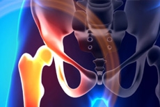 Does the Hip Capsule Heal on Its Own After Arthroscopic Surgery? New Research Offers Insig...