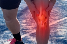 Should You Wait for ACL Surgery? New Research Shows Early Reconstruction May Protect Your ...