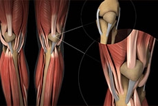 Why Treating the Whole Knee Matters in Cartilage Restoration Surgery