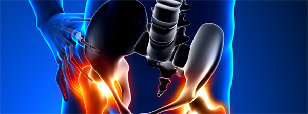 Do the Results of Hip Arthroscopy Last? Five-Year Outcomes in Basketball Players