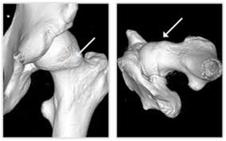Why Fixing a Torn Knee Root May Be the Best Choice for Long-Term Relief