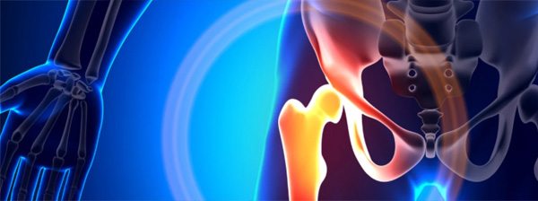Hip Capsule Heal on Its Own After Arthroscopic Surgery