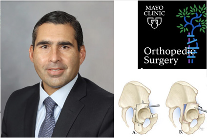 Hip Anatomy Video, Hip Orthopaedics Videos